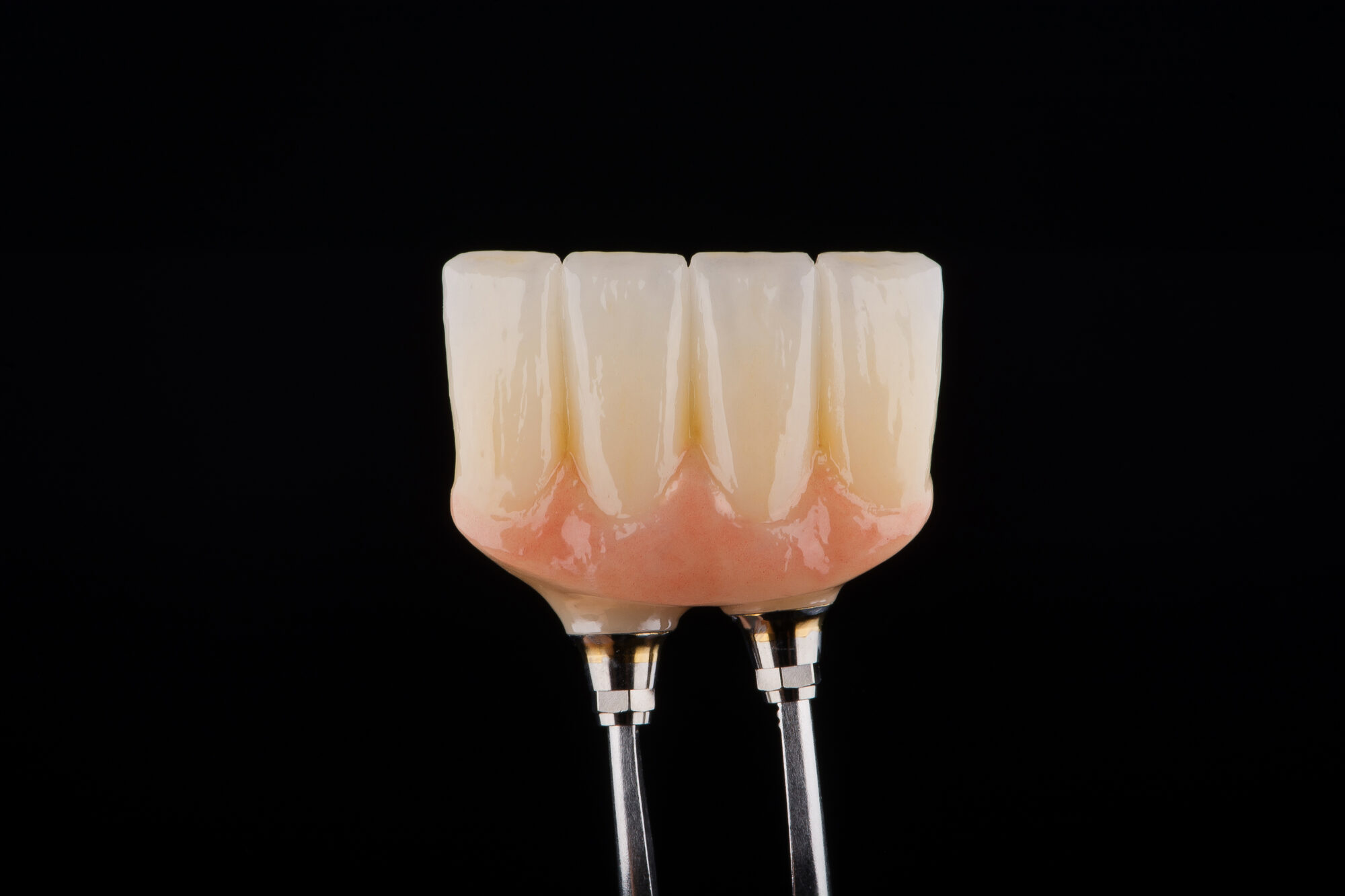 Su fondo nero, un ponte in ceramica a quattro elementi con gengiva artificiale rosa, sostenuto da due connessioni metalliche.