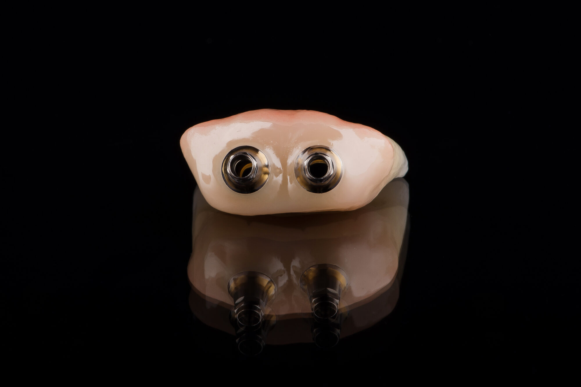 Ponte in zirconio con gengiva artificiale su due monconi in titanio, per il fissaggio su impianti.