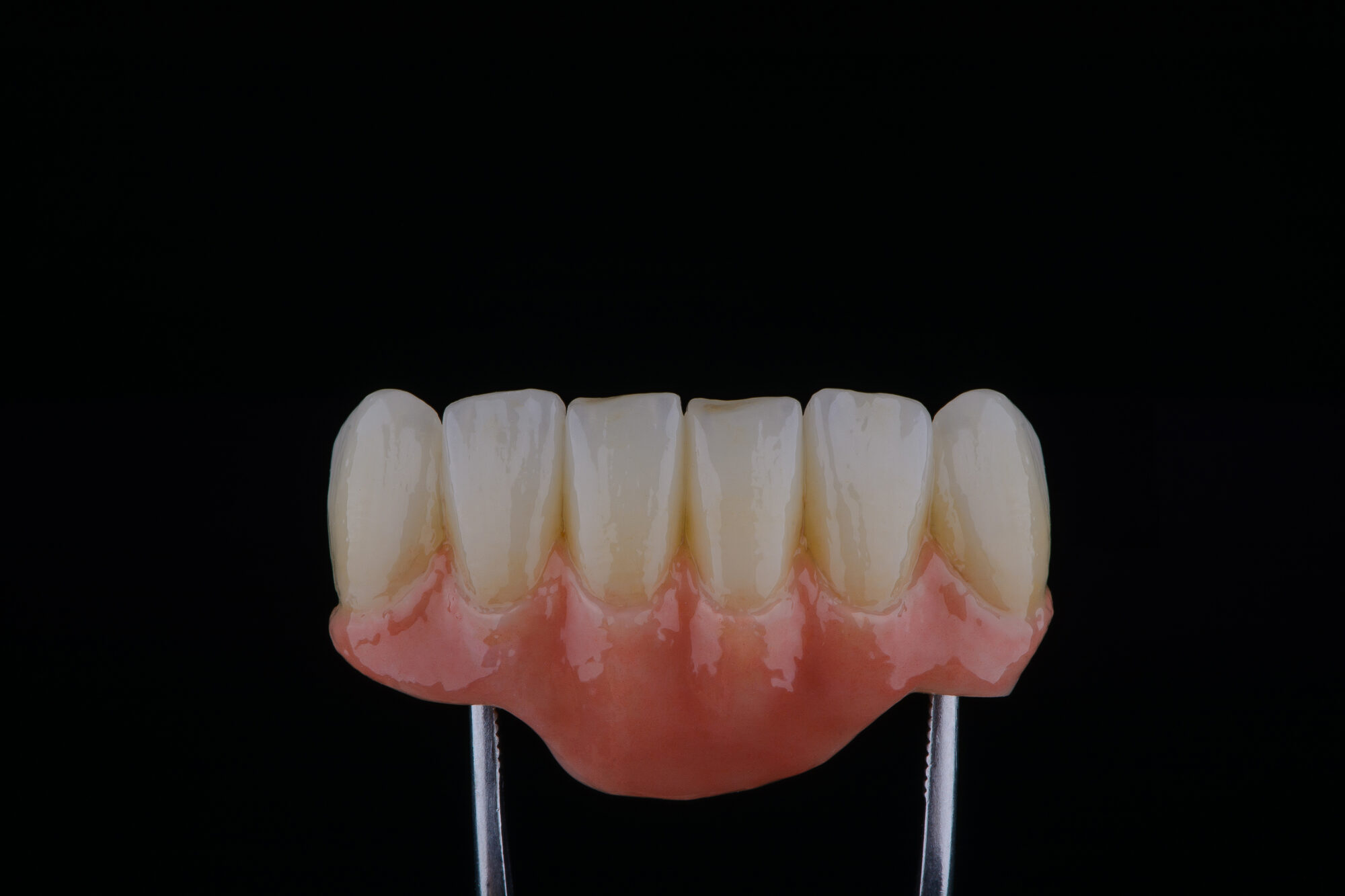 Manufatto protesico del settore frontale in ceramica con gengiva artificiale rosa, tenuto da una pinza su fondo nero