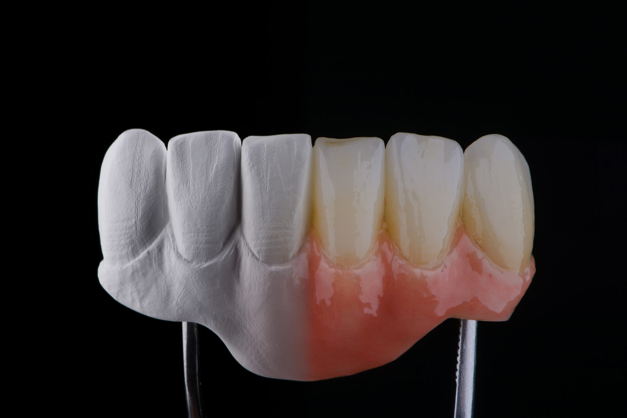 Manufatto protesico fotografato su fondo nero e tenuto da una pinza: meta' in zirconia bianca opaca non rifinita, meta' rivestita di ceramica con gengiva rosa