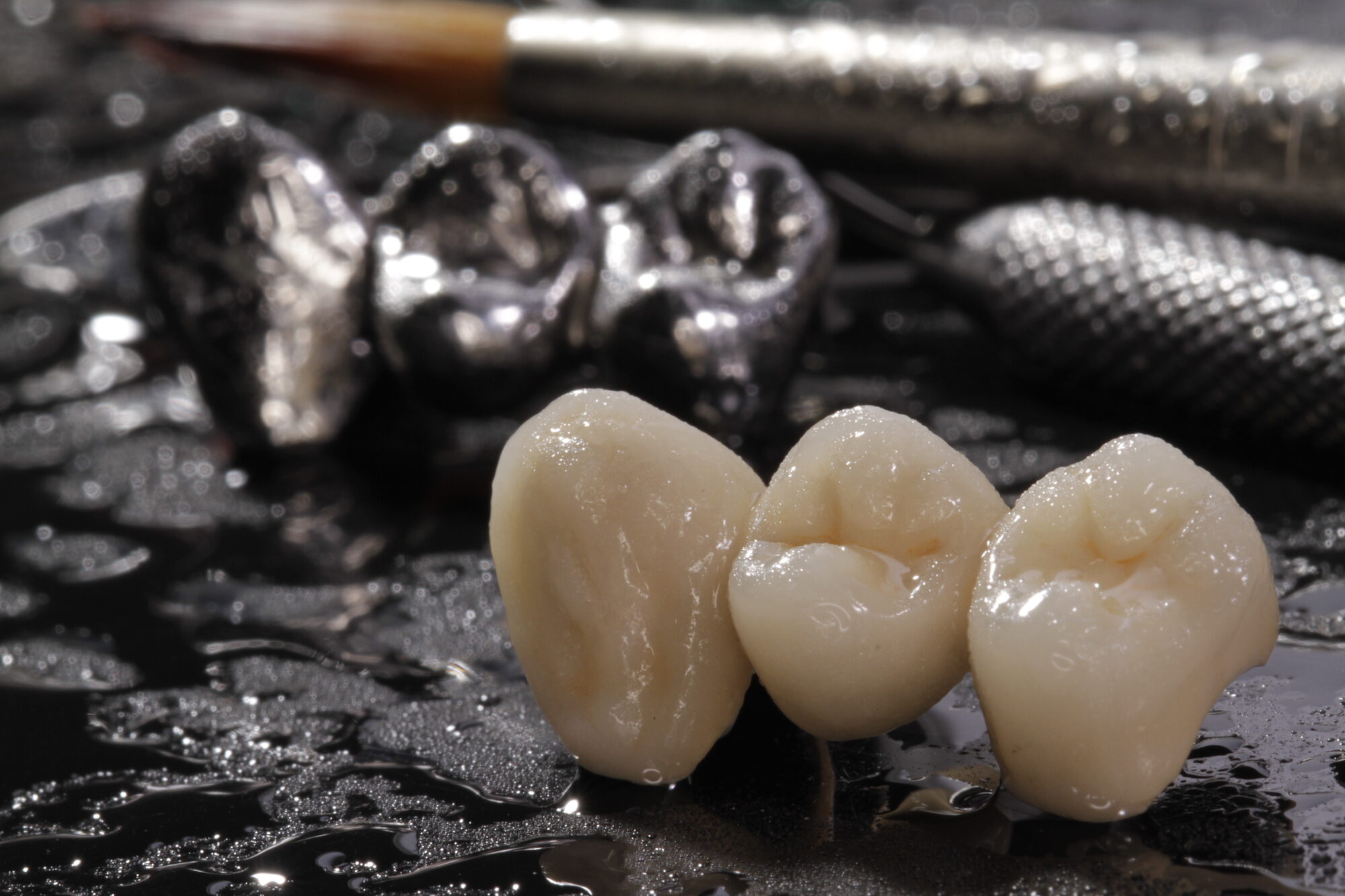 Manufatti in ceramica pressata e metallo-ceramica mostrati a confronto