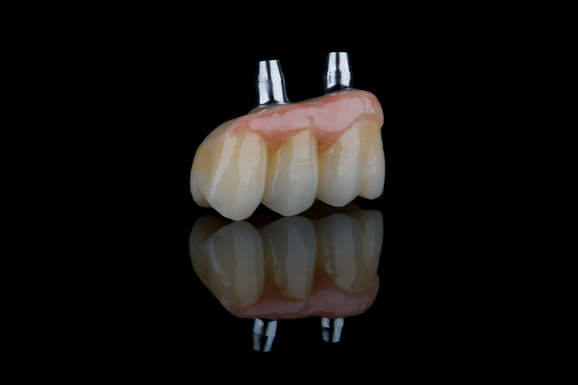 Ponte dentale di quattro elementi in ceramica con gengiva artificiale rosa, su due monconi in titanio, fotografato su fondo nero riflettente
