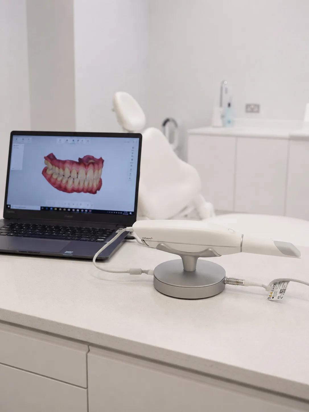 Scanner intraorale reale nello Studio Dentistico Lera